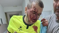 Prvoligaš Majevica dala podršku pretučenom sudiji Makariću, Prva liga Republike Srpske